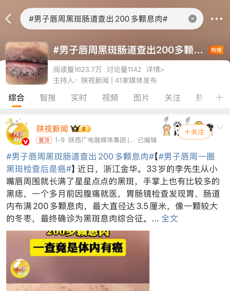 热搜！男子嘴唇长黑斑，竟查出200颗肠息肉