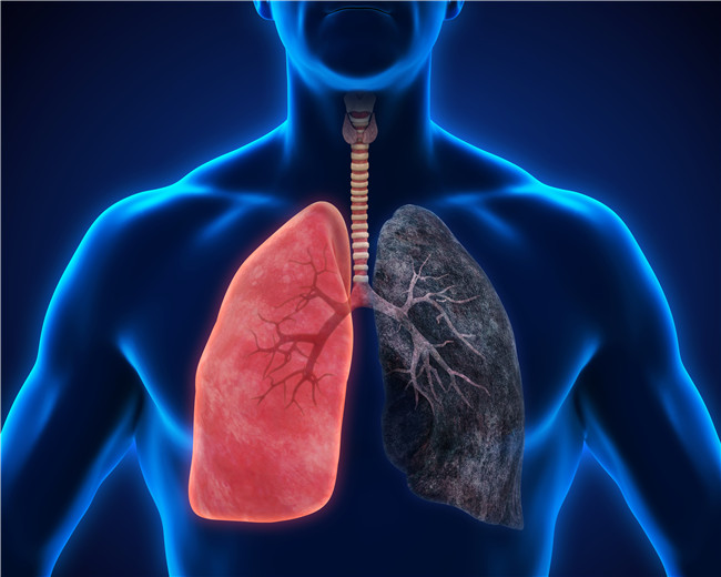 学习班报名丨早期肺癌克星的影像新技术都有啥？